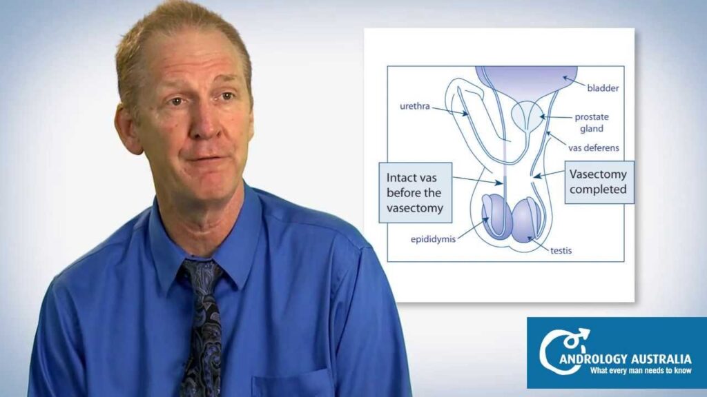 How Vasectomy in Auckland Offers a Simple and Reliable Birth Control Solution